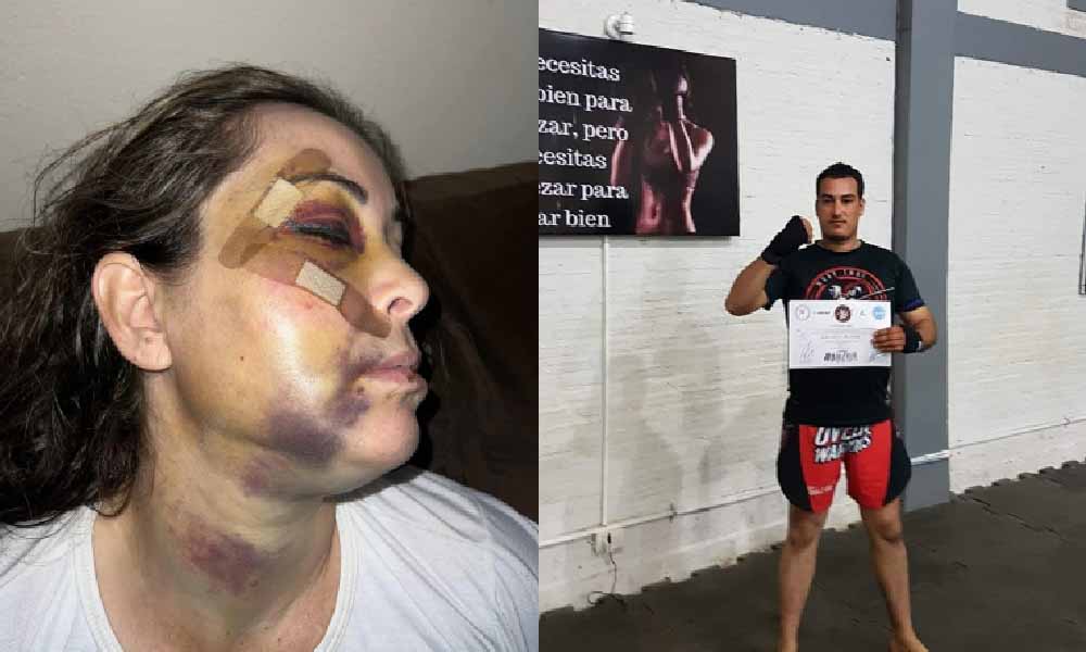 Coronel Oviedo: Hombre que agredió a su expareja sigue prófugo a un mes de brutal agresión