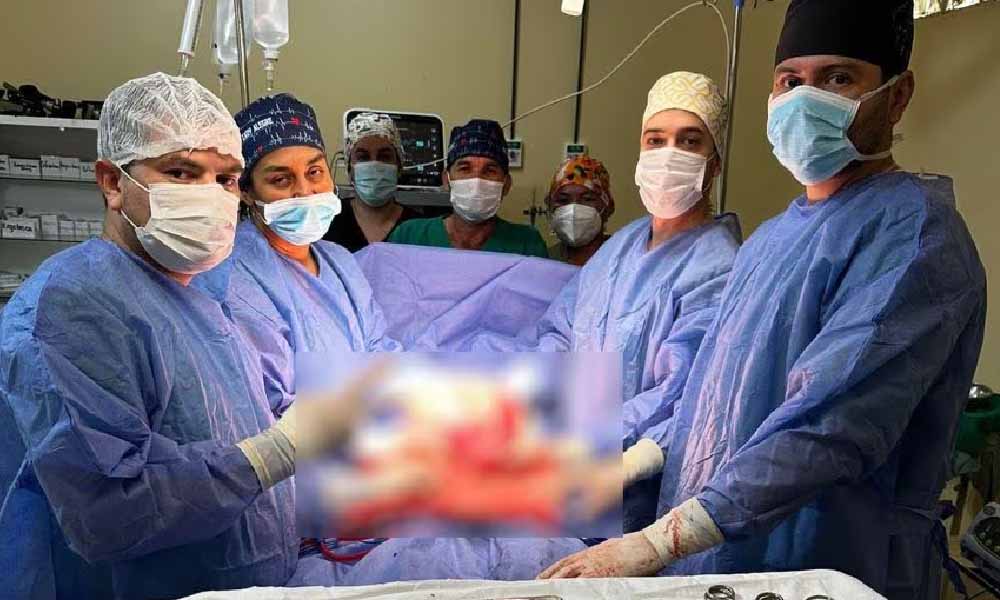 Extirpan tumor de 3 kilos a una paciente que dio a luz por cesárea
