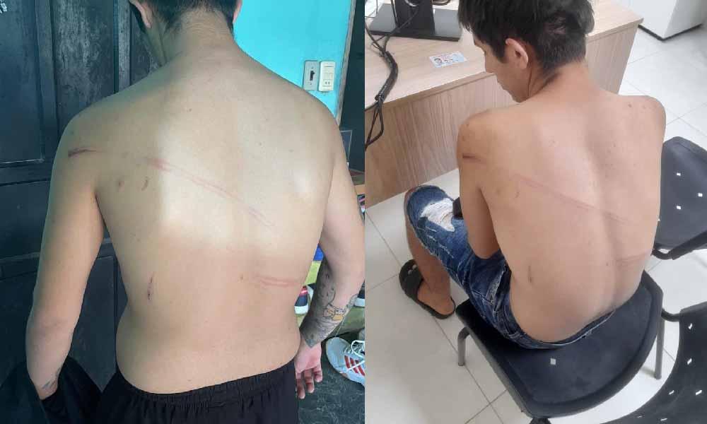 Linces habrían agredido, robado y amenazado a un joven en Coronel Oviedo